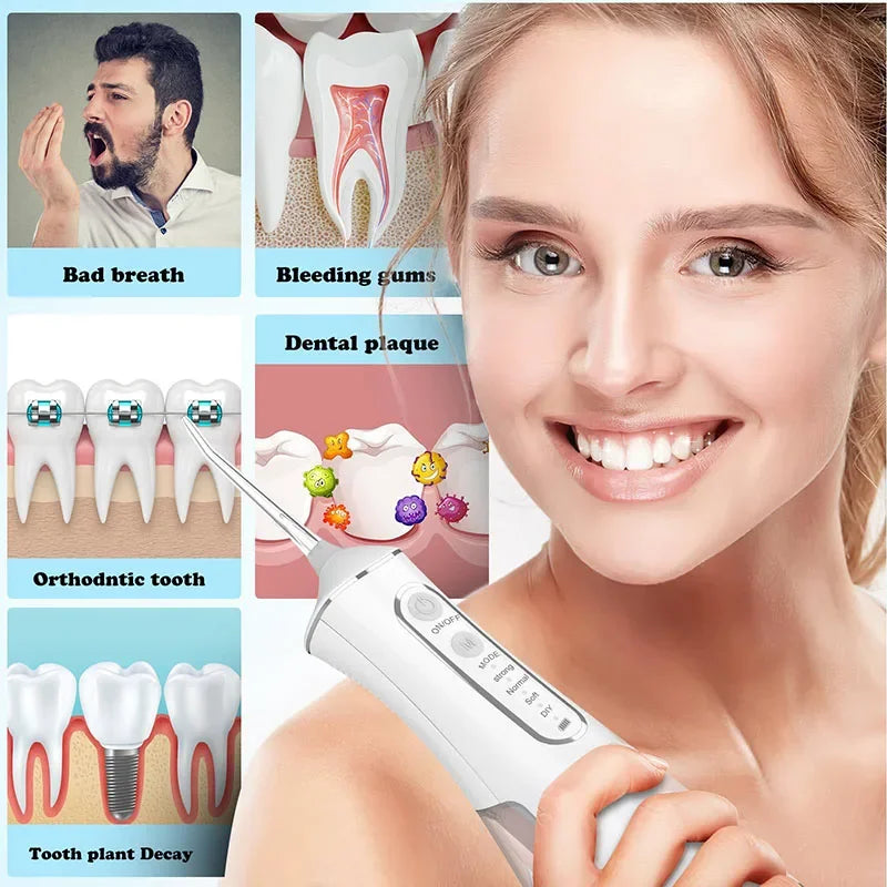 Ultimate Water Flosser Pro