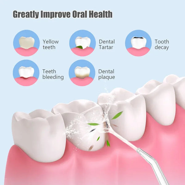 Pro-Dental-Oral-Irrigator-Flosser-Removal-Cleaning-Wireless-Brush-Ipx7-Store-Water-Floss-Irigator-Waterpick-For.jpg